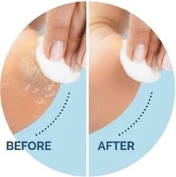 Scholl Velvet Smooth Voetvijl Wet & Dry - Starter - 1 Stuk 9 Scholl Velvet Smooth Voetvijl Wet & Dry - Starter - 1 Stuk -Cosmetica Winkel 1196x1200 2