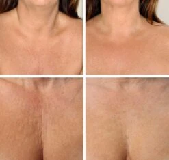 Simia™ Anti Rimpel Beauty Pads - Decolleté Large T Shape Set (2 Stuks) - Herbruikbaar Anti Aging Siliconen Pad Tegen Lijntjes En Slaaprimpels 10 Simia™ Anti Rimpel Beauty Pads - Decolleté Large T Shape Set (2 Stuks) - Herbruikbaar Anti Aging Siliconen Pad Tegen Lijntjes En Slaaprimpels -Cosmetica Winkel 1200x1139