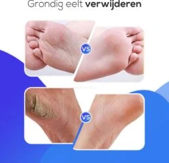 LifeWise Elektrische Eelt Verwijderaar - Voetvijl - 60 Vervangbare Schuurpads - Netstroom Adapter -Cosmetica Winkel 1200x1155 1