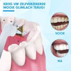 DEN-T® PRO P350 Elektrische Tandenpolijster - Wit - 5 Standen - 5 Opzetstukken - Polijstmachine - Polijstset - Tanden Polijsten - 14 DEN-T® PRO P350 Elektrische Tandenpolijster - Wit - 5 Standen - 5 Opzetstukken - Polijstmachine - Polijstset - Tanden Polijsten - -Cosmetica Winkel 1200x1200 326