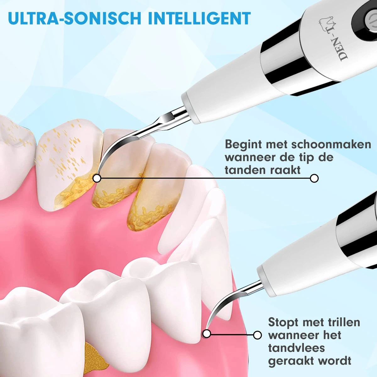 DEN-T® PRO U500 - Elektrische Sonische Tandsteen Verwijderaar - Wit 4 DEN-T® PRO U500 - Elektrische Sonische Tandsteen Verwijderaar - Wit - Afbeelding 2