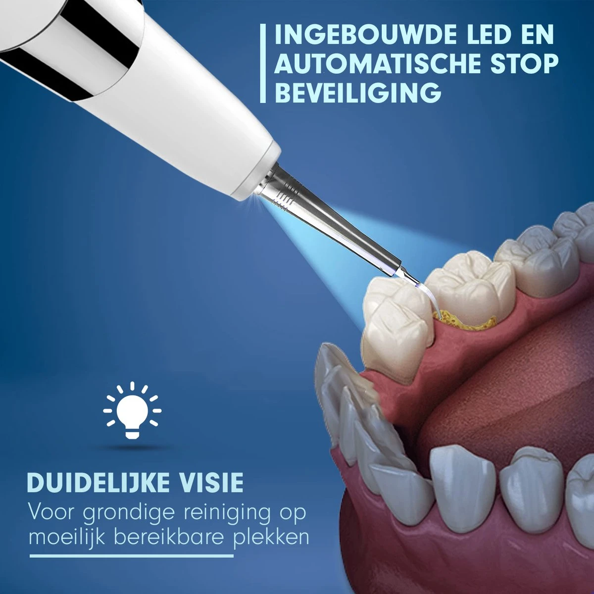 DEN-T® PRO U500 - Elektrische Sonische Tandsteen Verwijderaar - Wit 5 DEN-T® PRO U500 - Elektrische Sonische Tandsteen Verwijderaar - Wit - Afbeelding 3