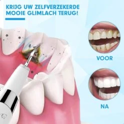 DEN-T® PRO U500 - Elektrische Sonische Tandsteen Verwijderaar - Wit 23 DEN-T® PRO U500 - Elektrische Sonische Tandsteen Verwijderaar - Wit -Cosmetica Winkel 1200x1200 356