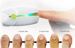 Anti Schimmelnagel Kalknagel Laserapparaat Om Zelf Te Behandelen, Veilig, Effectief, Snel En Pijnloos, Koude Laser Behandeling Voor Thuisgebruik, Voor Tenen En Vingers. Oplaadbaar. 12 Anti Schimmelnagel Kalknagel Laserapparaat Om Zelf Te Behandelen, Veilig, Effectief, Snel En Pijnloos, Koude Laser Behandeling Voor Thuisgebruik, Voor Tenen En Vingers. Oplaadbaar. -Cosmetica Winkel 1200x774